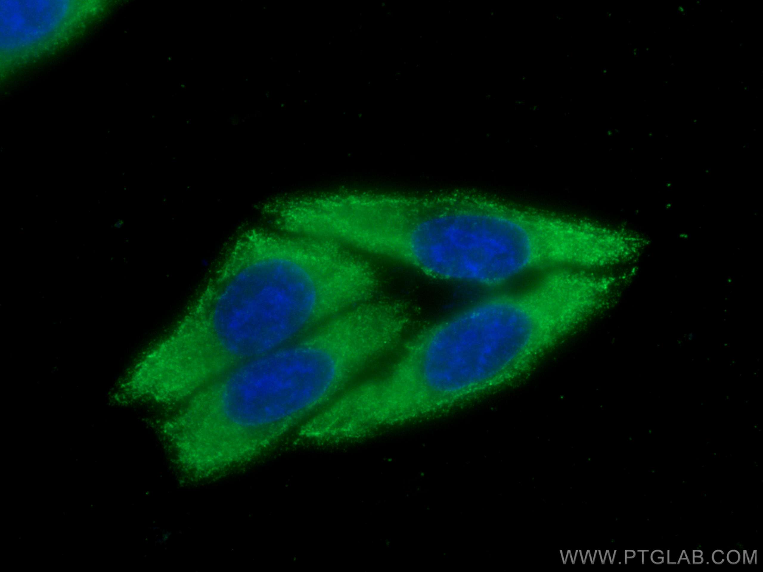 Immunofluorescence (IF) / fluorescent staining of HepG2 cells using CoraLite® Plus 488-conjugated PLA2G4D Monoclonal a (CL488-66752)