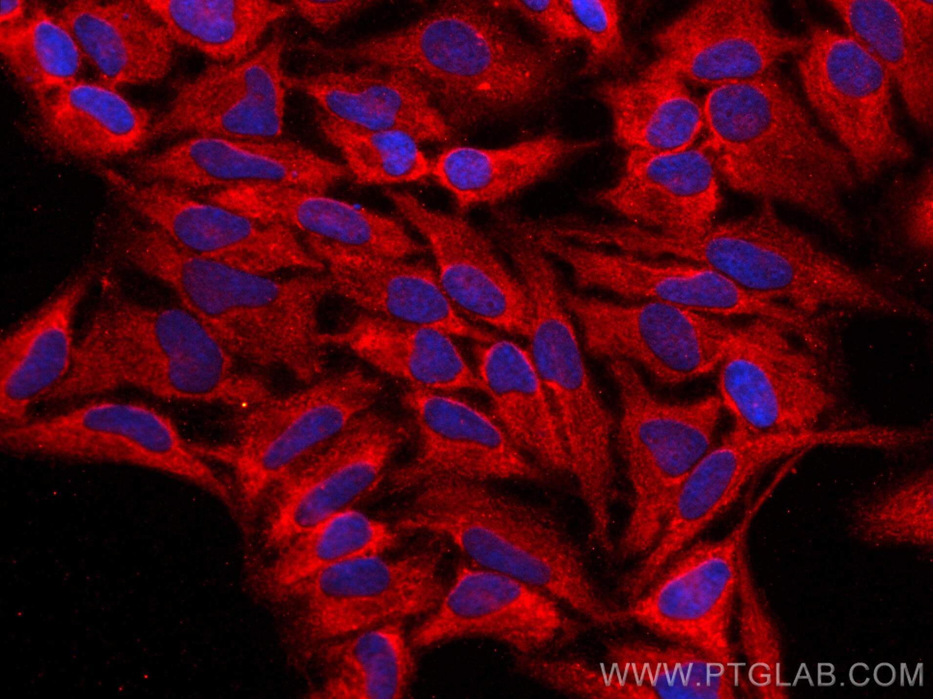 Immunofluorescence (IF) / fluorescent staining of HeLa cells using PLA2G4E Polyclonal antibody (18088-1-AP)