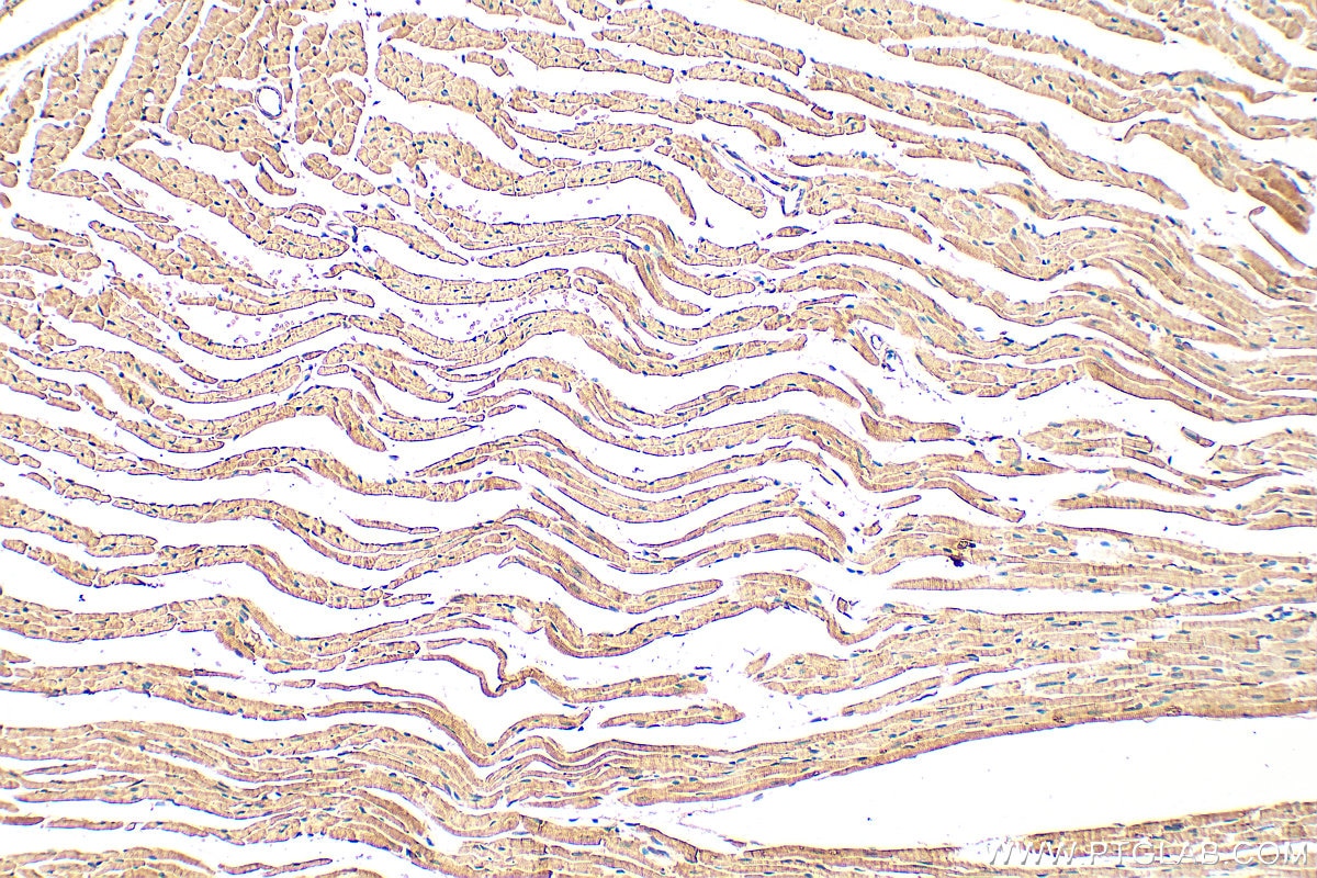 Immunohistochemistry (IHC) staining of mouse heart tissue using PLA2G4E Polyclonal antibody (18088-1-AP)