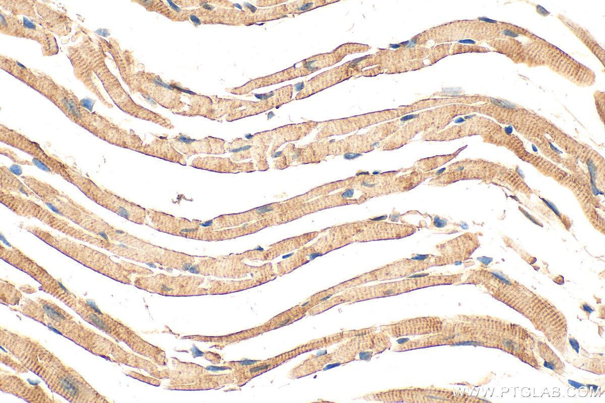 Immunohistochemistry (IHC) staining of mouse heart tissue using PLA2G4E Polyclonal antibody (18088-1-AP)