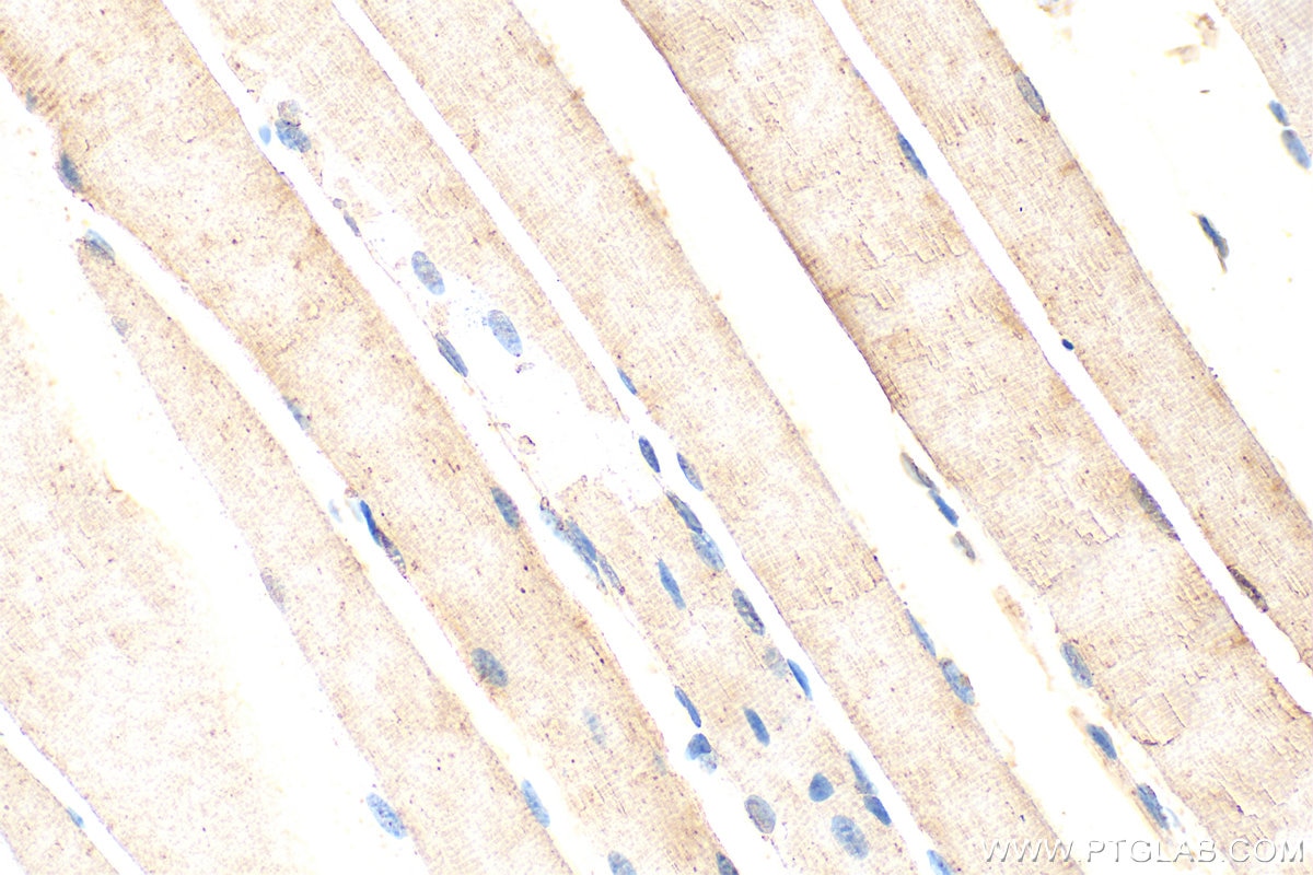 Immunohistochemistry (IHC) staining of mouse skeletal muscle tissue using PLA2G4E Polyclonal antibody (18088-1-AP)