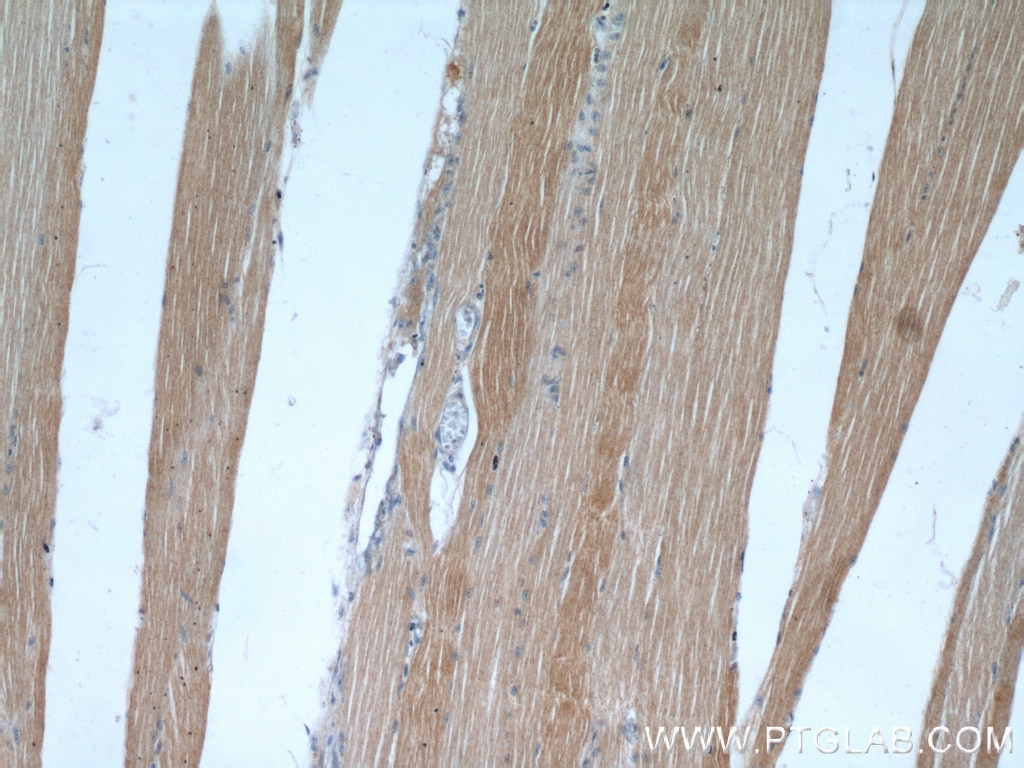 IHC staining of human skeletal muscle using 18088-1-AP
