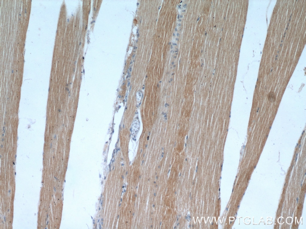 Immunohistochemistry (IHC) staining of human skeletal muscle tissue using PLA2G4E Polyclonal antibody (18088-1-AP)