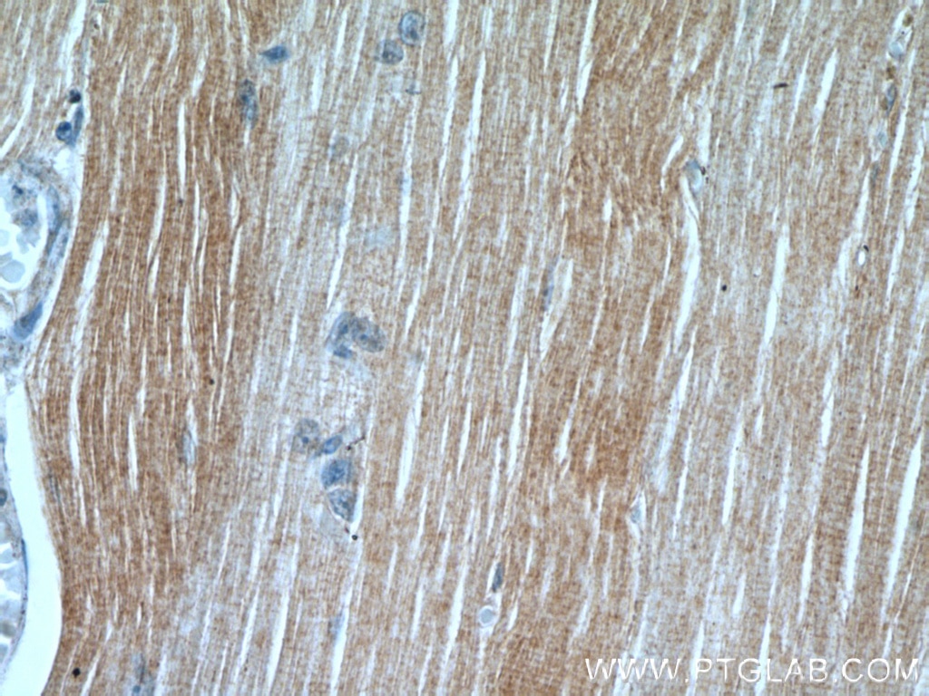 Immunohistochemistry (IHC) staining of human skeletal muscle tissue using PLA2G4E Polyclonal antibody (18088-1-AP)