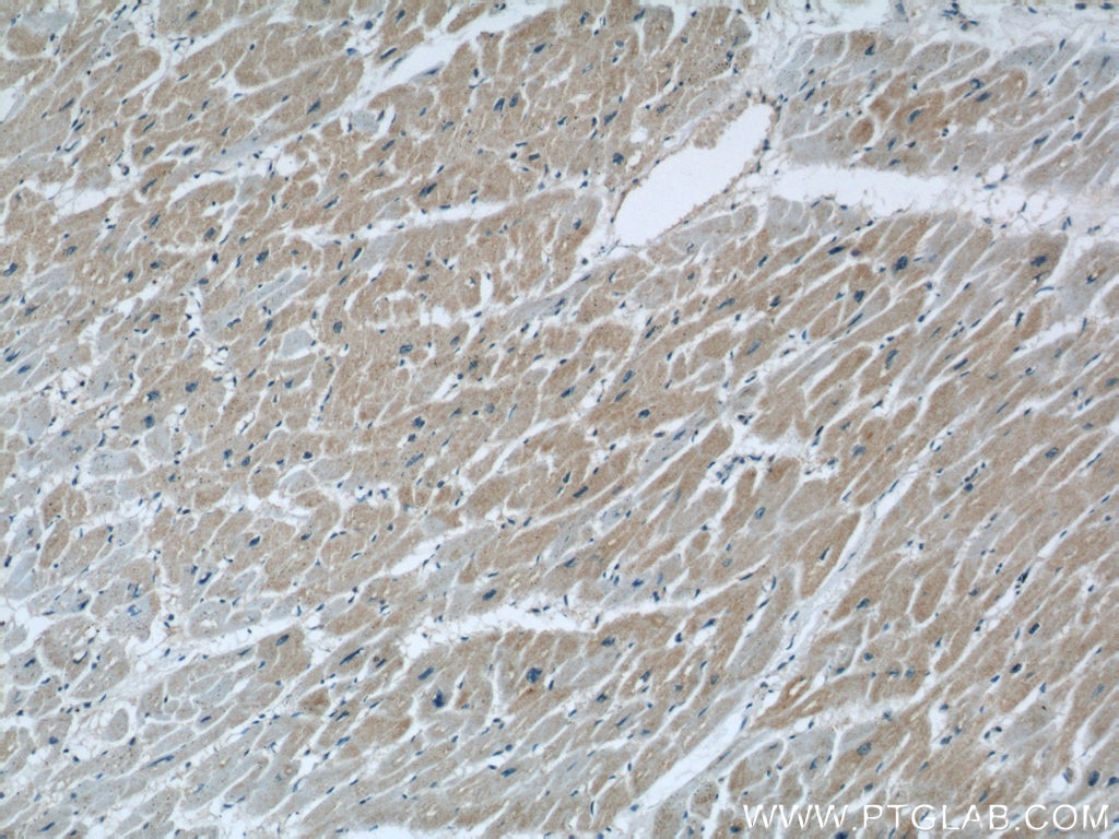 IHC staining of human heart using 18088-1-AP