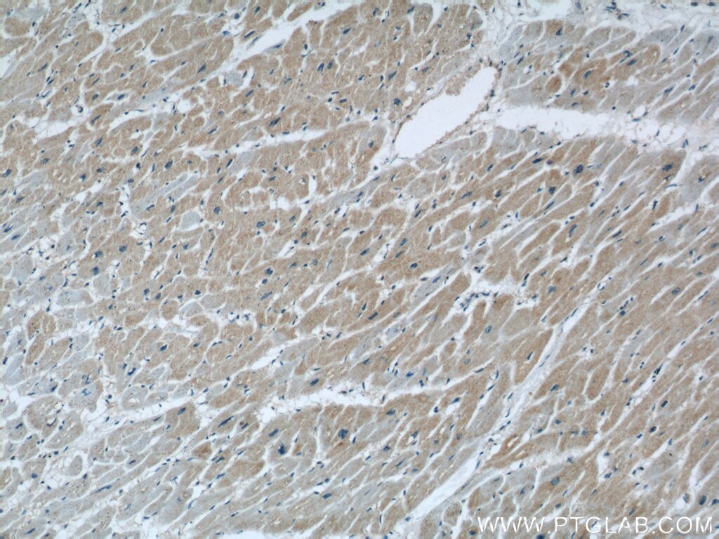 Immunohistochemistry (IHC) staining of human heart tissue using PLA2G4E Polyclonal antibody (18088-1-AP)