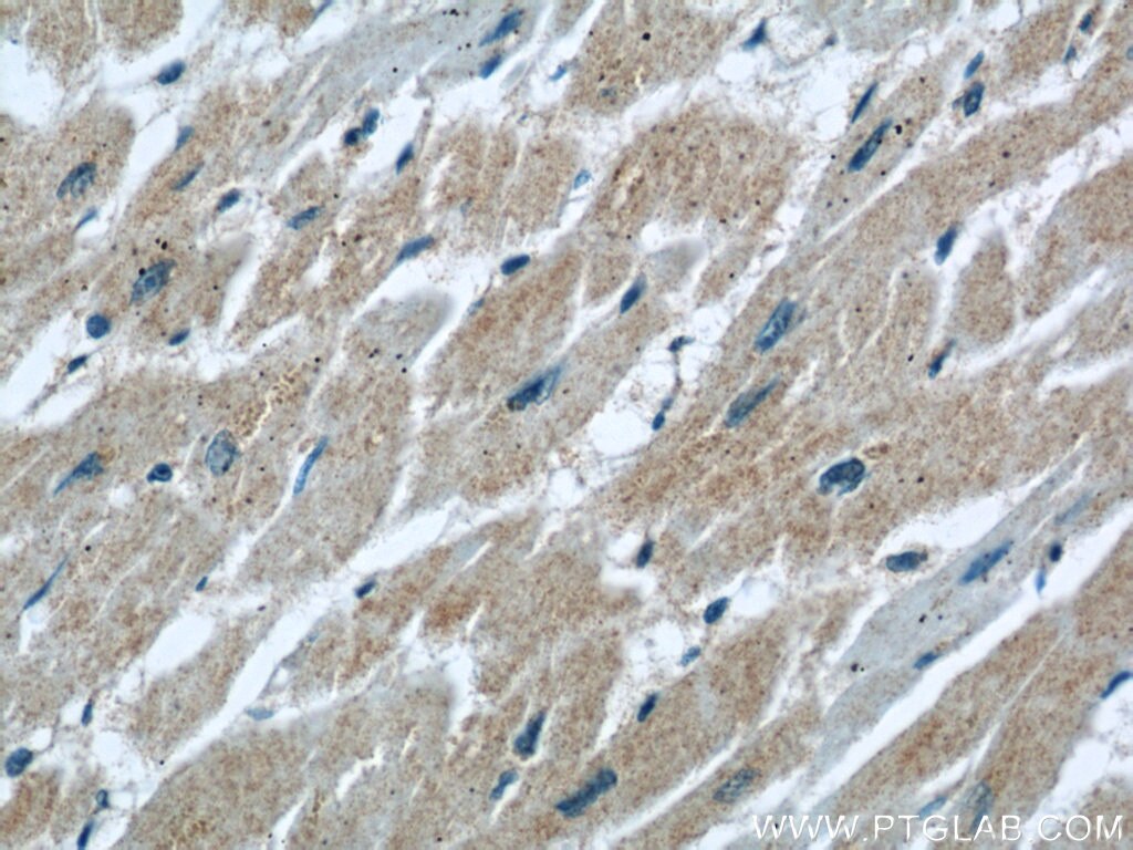 Immunohistochemistry (IHC) staining of human heart tissue using PLA2G4E Polyclonal antibody (18088-1-AP)