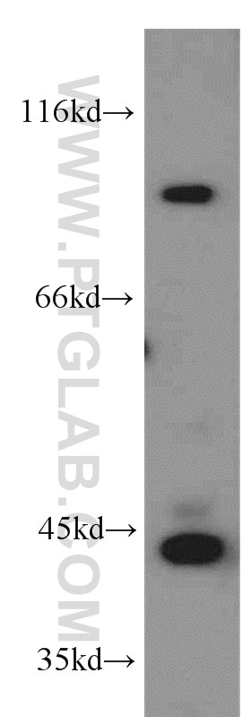 Western Blot (WB) analysis of SH-SY5Y cells using PLA2G4E Polyclonal antibody (18088-1-AP)