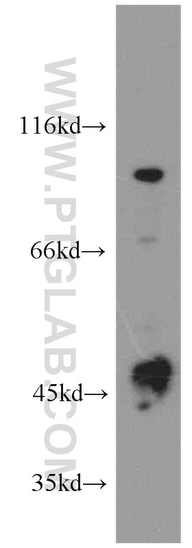 Western Blot (WB) analysis of SW 1990 cells using PLA2G4E Polyclonal antibody (18088-1-AP)