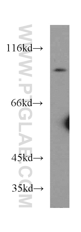 Western Blot (WB) analysis of mouse thymus tissue using PLA2G4E Polyclonal antibody (18088-1-AP)