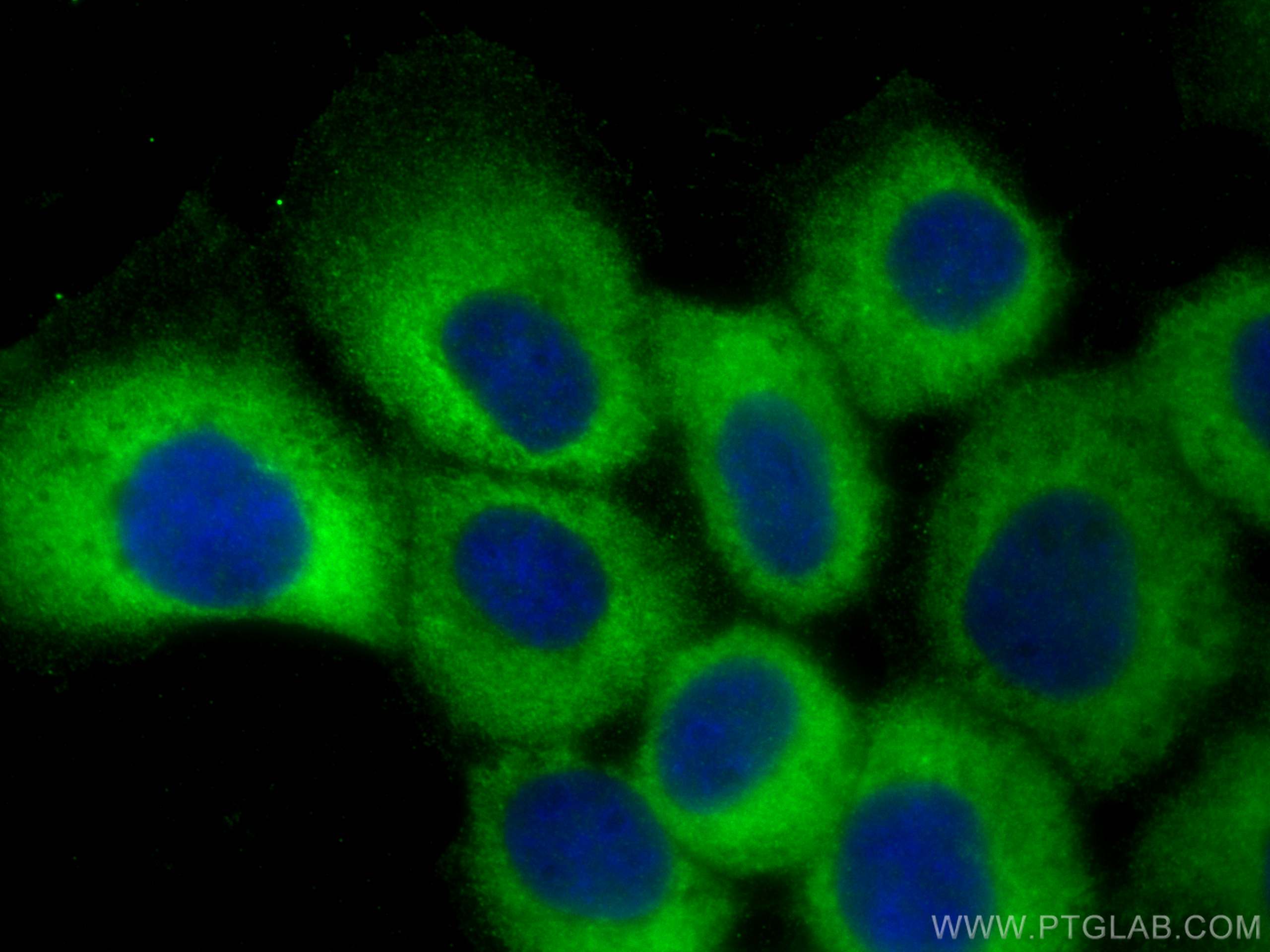 Immunofluorescence (IF) / fluorescent staining of A431 cells using PLA2G4E Polyclonal antibody (29990-1-AP)