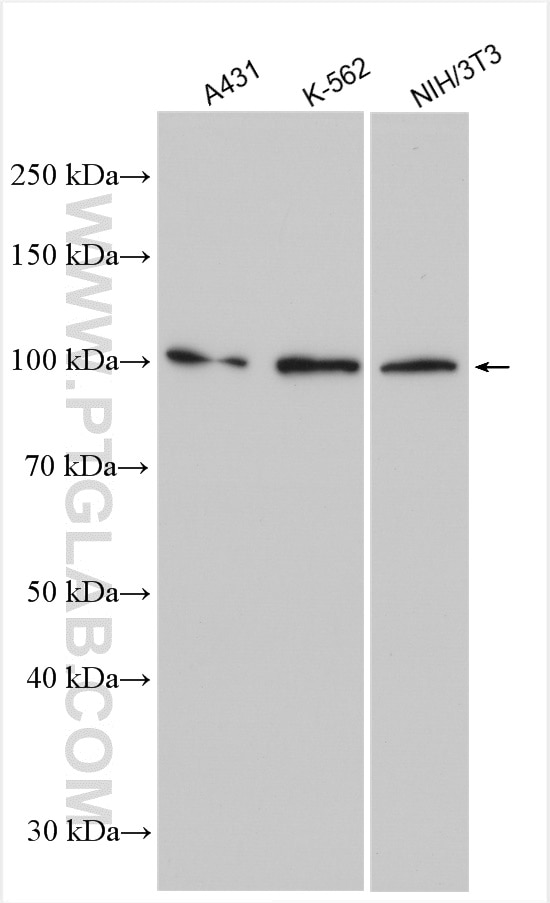 Western Blot (WB) analysis of various lysates using PLA2G4E Polyclonal antibody (29990-1-AP)