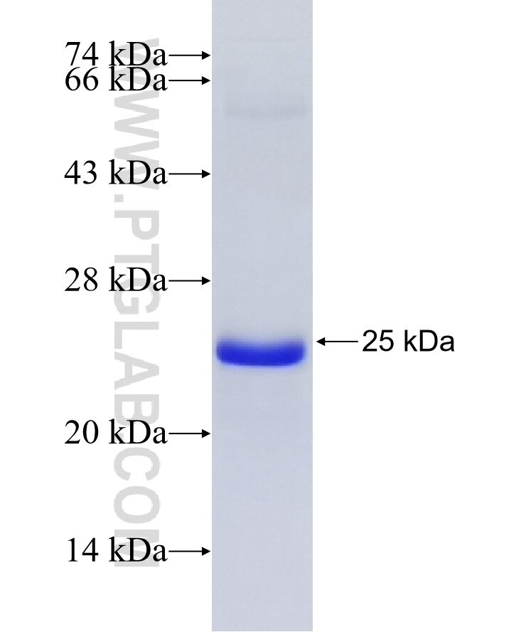 PLA2G4E fusion protein Ag32321 SDS-PAGE PLA2G4E fusion protein Ag32321 SDS-PAGE
