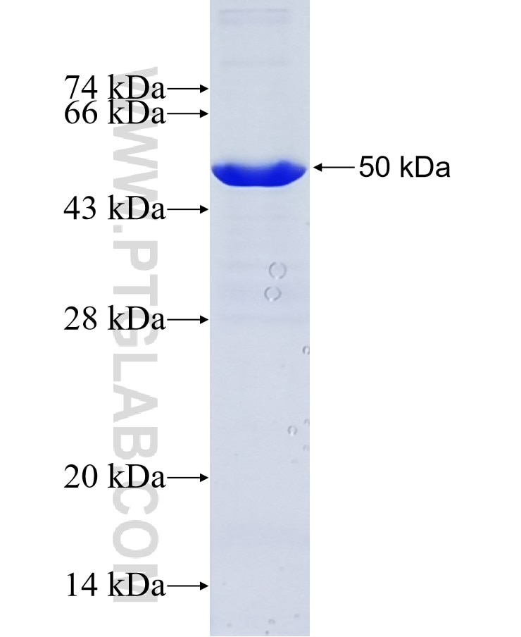 PLA2G4E fusion protein Ag12548 SDS-PAGE