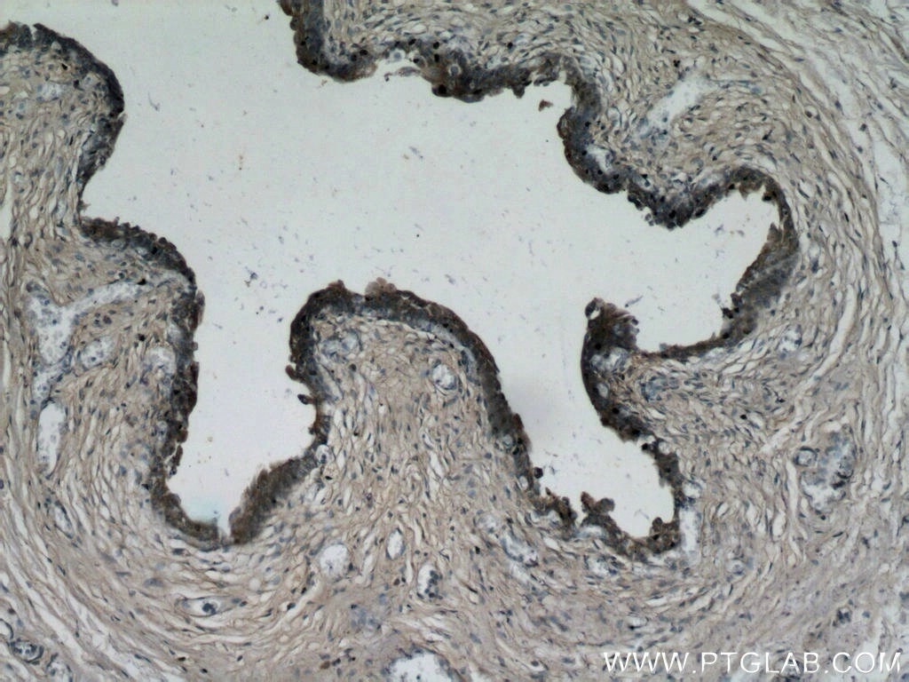 Immunohistochemistry (IHC) staining of human bladder tissue using PLA2G4F Polyclonal antibody (21411-1-AP)