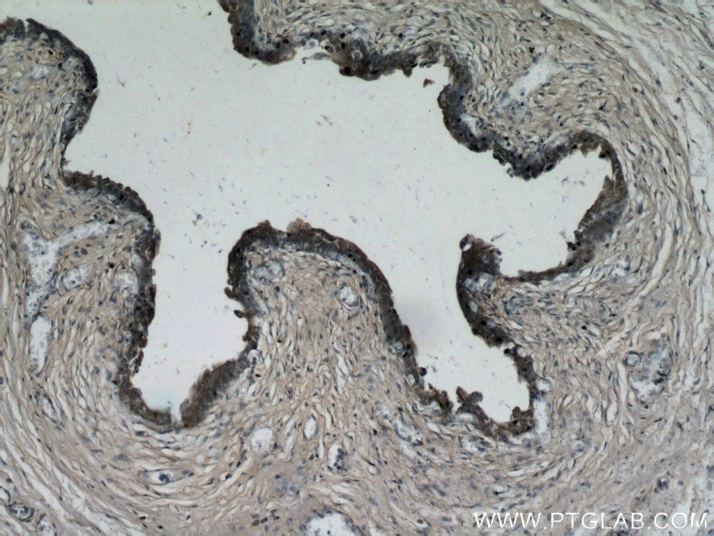 IHC staining of human bladder using 21411-1-AP