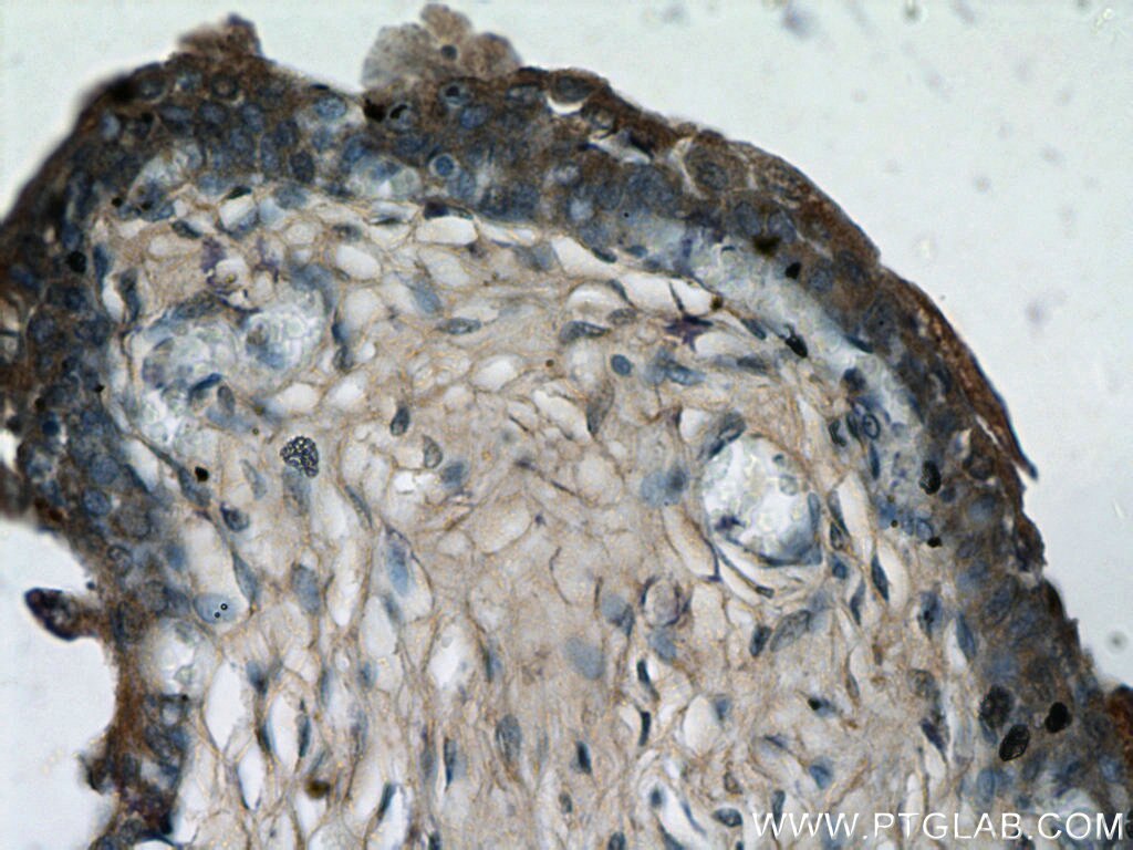 IHC staining of human bladder using 21411-1-AP