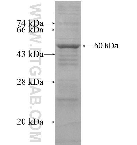 PLA2G4F fusion protein Ag15571 SDS-PAGE