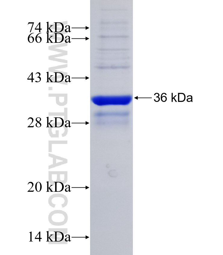PLA2G5 fusion protein Ag29302 SDS-PAGE PLA2G5 fusion protein Ag29302 SDS-PAGE