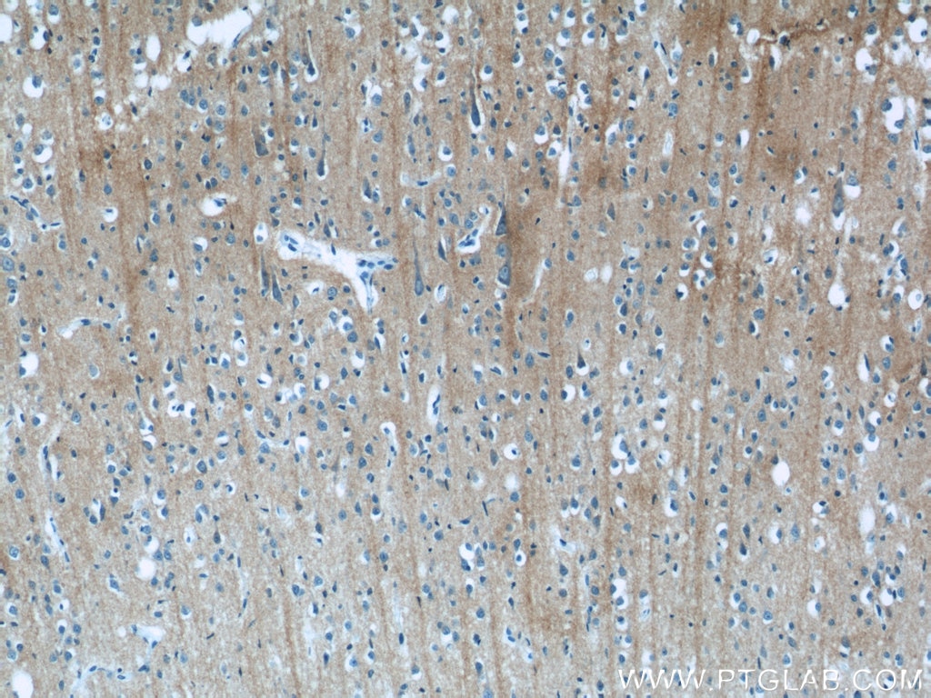 Immunohistochemistry (IHC) staining of human brain tissue using iPLA2 Polyclonal antibody (22030-1-AP)