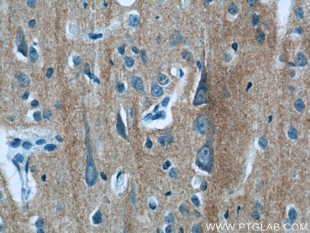 Immunohistochemistry (IHC) staining of human brain tissue using iPLA2 Polyclonal antibody (22030-1-AP)