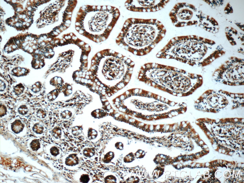 Immunohistochemistry (IHC) staining of human small intestine tissue using iPLA2 Polyclonal antibody (22030-1-AP)