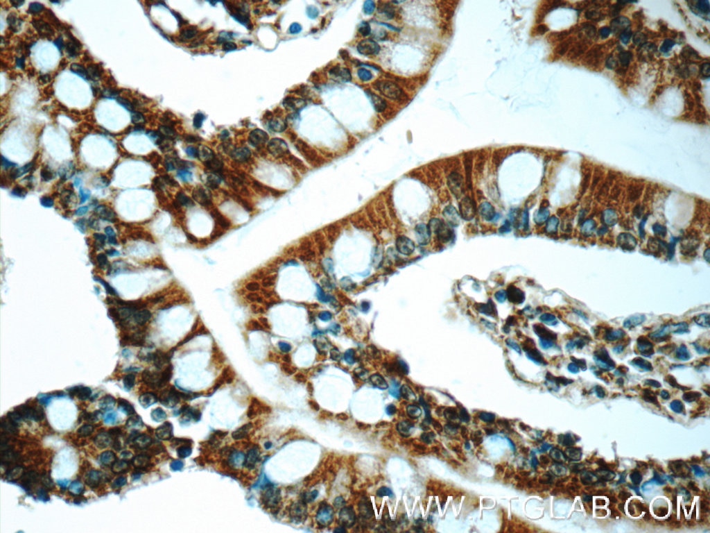 Immunohistochemistry (IHC) staining of human small intestine tissue using iPLA2 Polyclonal antibody (22030-1-AP)