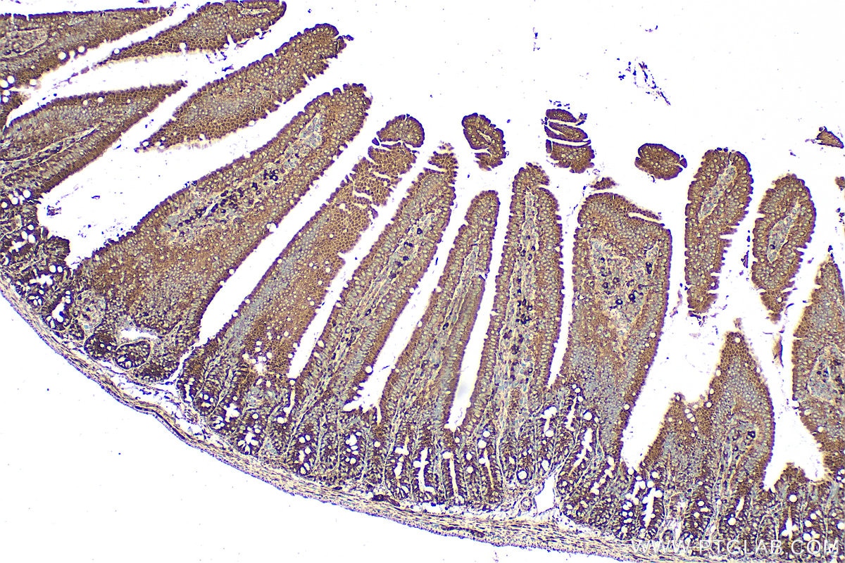 Immunohistochemistry (IHC) staining of mouse small intestine tissue using iPLA2 Polyclonal antibody (22030-1-AP)