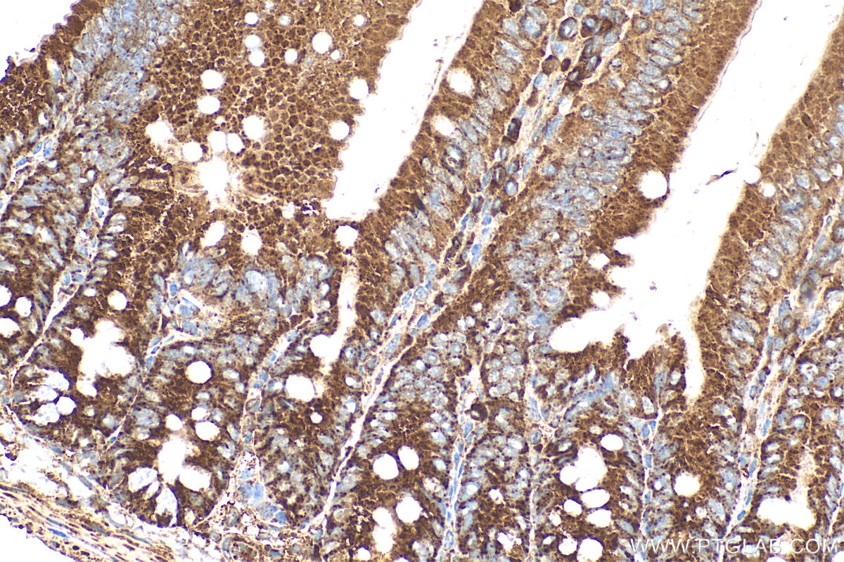 Immunohistochemistry (IHC) staining of mouse small intestine tissue using iPLA2 Polyclonal antibody (22030-1-AP)