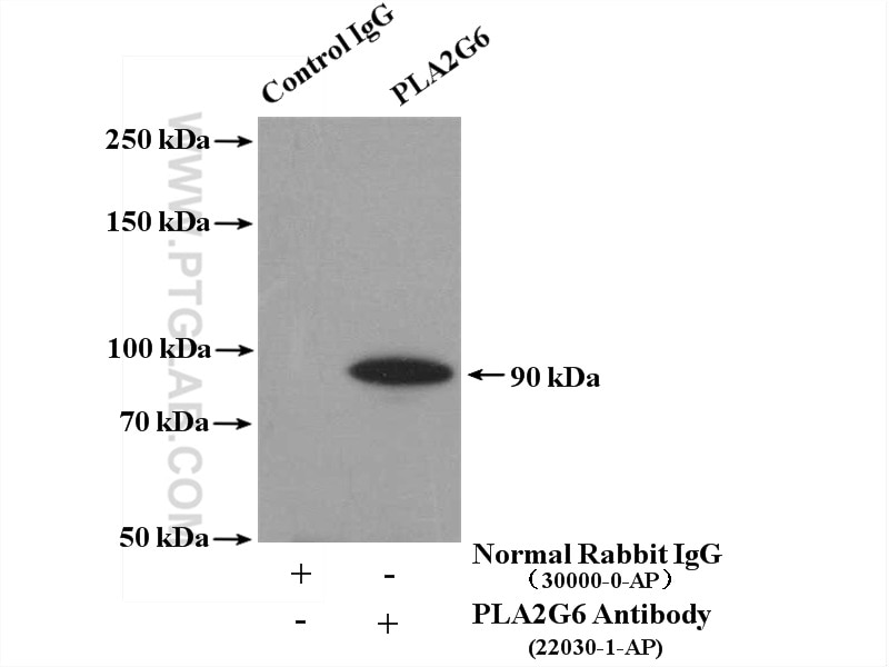 Immunoprecipitation (IP) experiment of mouse testis tissue using iPLA2 Polyclonal antibody (22030-1-AP)