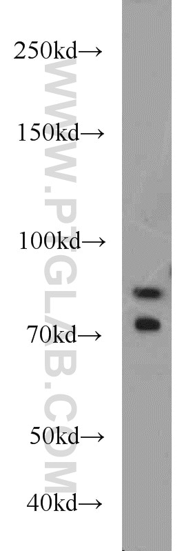 Western Blot (WB) analysis of mouse testis tissue using iPLA2 Polyclonal antibody (22030-1-AP)
