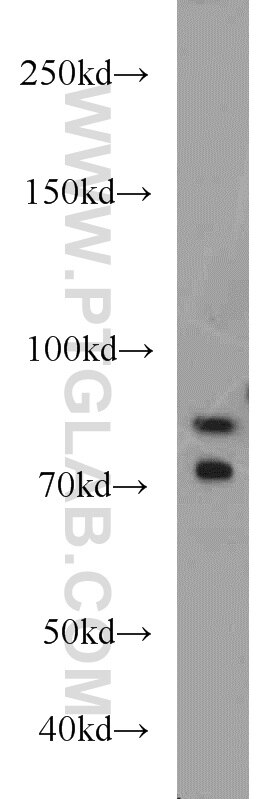 Western Blot (WB) analysis of mouse testis tissue using iPLA2 Polyclonal antibody (22030-1-AP)