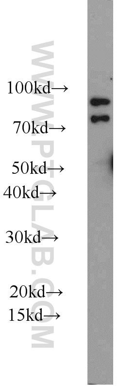 Western Blot (WB) analysis of mouse testis tissue using iPLA2 Polyclonal antibody (22030-1-AP)