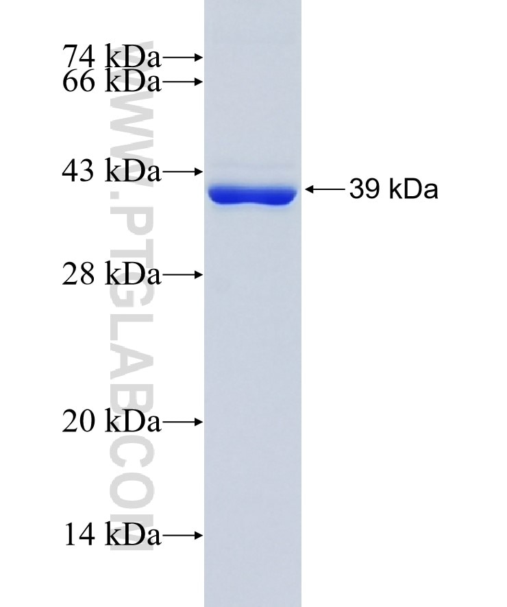 PLA2G6 fusion protein Ag16896 SDS-PAGE