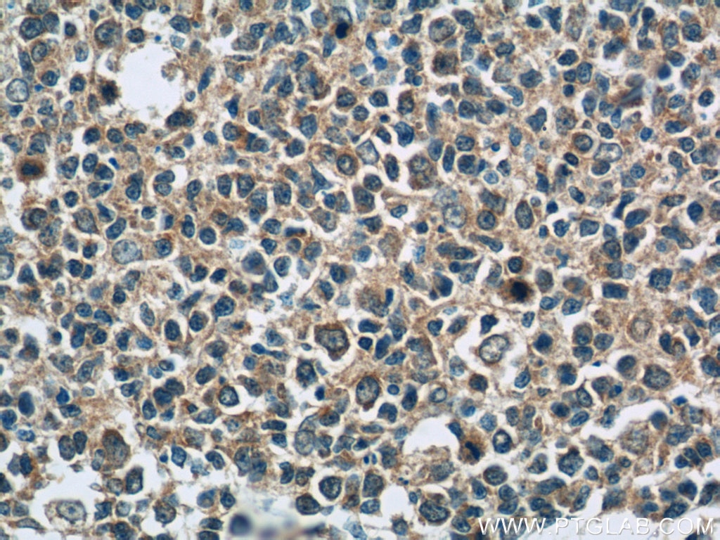 PAFAH Polyclonal antibody