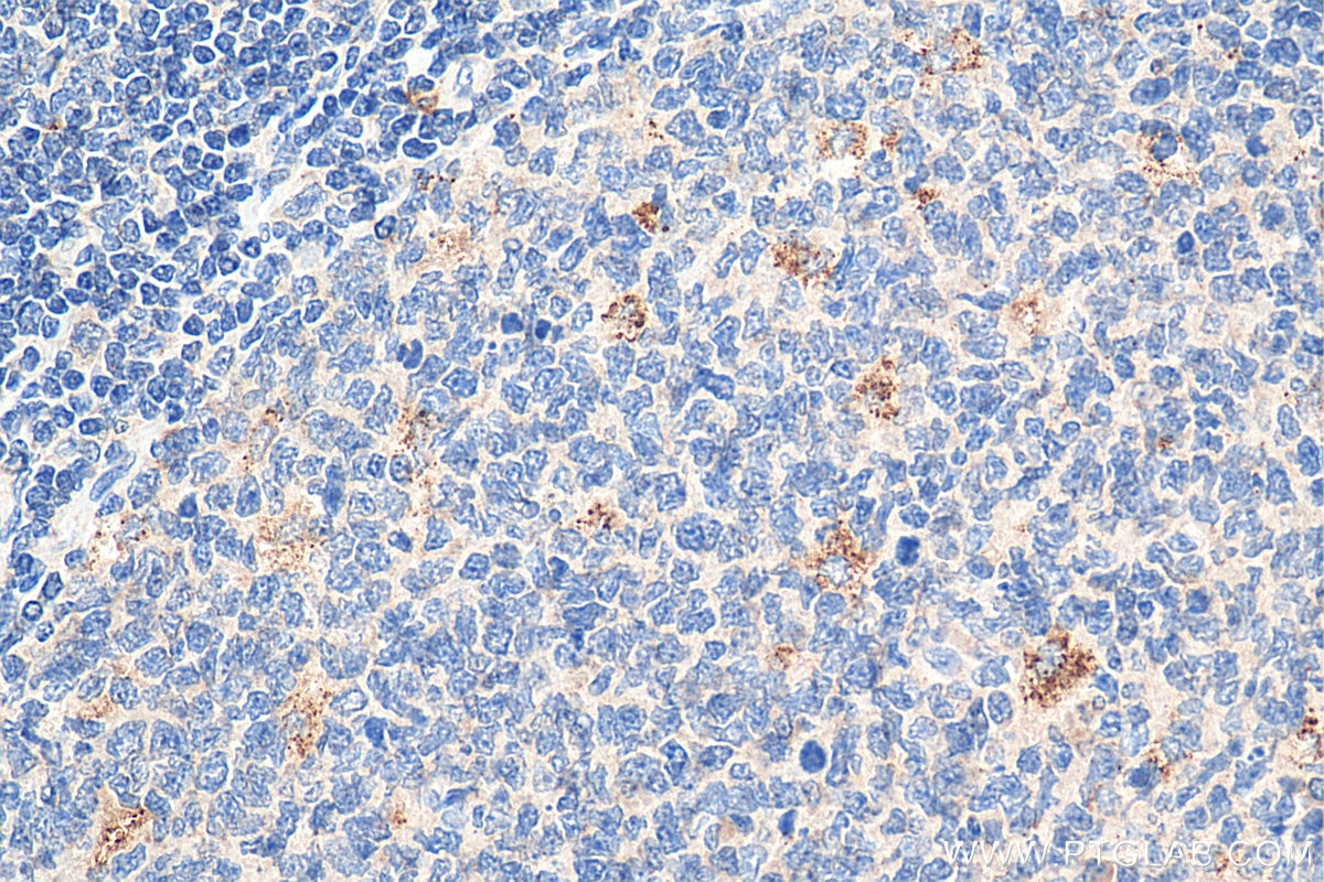 Immunohistochemistry (IHC) staining of human tonsillitis tissue using PAFAH Polyclonal antibody (15526-1-AP)