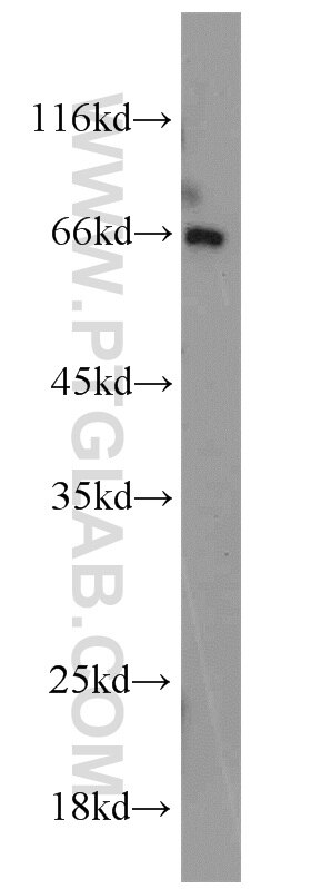 Western Blot (WB) analysis of mouse liver tissue using PAFAH Polyclonal antibody (15526-1-AP)