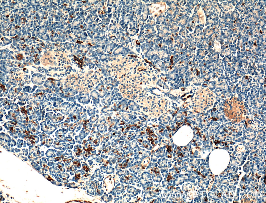 Immunohistochemistry (IHC) staining of human pancreas tissue using PLA2R1 Polyclonal antibody (18798-1-AP)