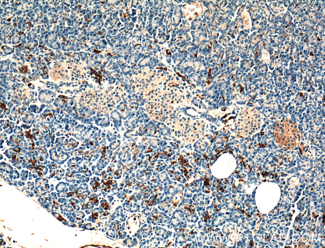 Immunohistochemistry (IHC) staining of human pancreas tissue using PLA2R1 Polyclonal antibody (18798-1-AP)