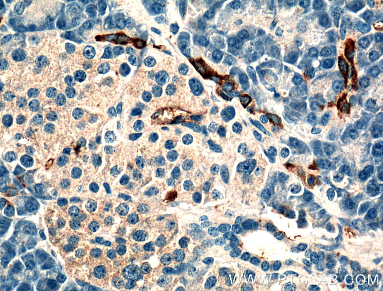 Immunohistochemistry (IHC) staining of human pancreas tissue using PLA2R1 Polyclonal antibody (18798-1-AP)