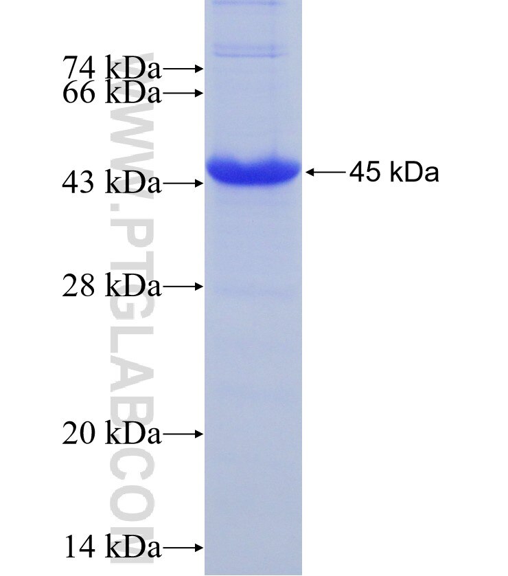 PLA2R1 fusion protein Ag22448 SDS-PAGE