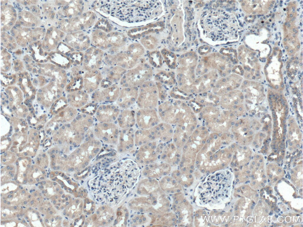 Immunohistochemistry (IHC) staining of human kidney tissue using PLAA Polyclonal antibody (12529-1-AP)