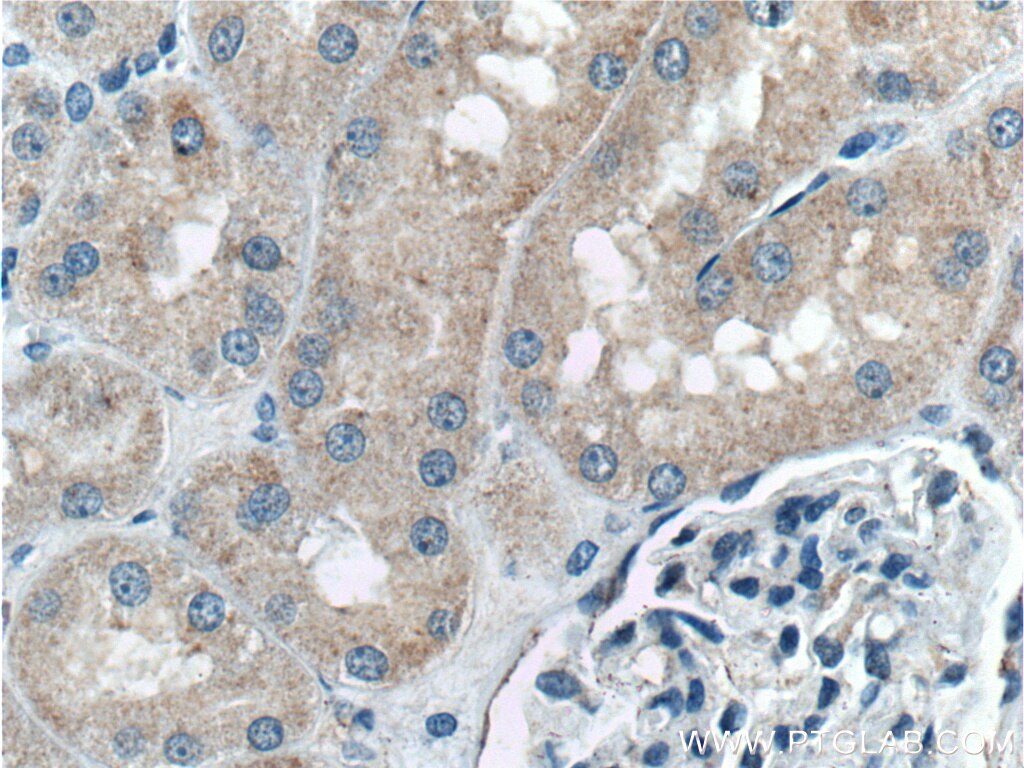 Immunohistochemistry (IHC) staining of human kidney tissue using PLAA Polyclonal antibody (12529-1-AP)