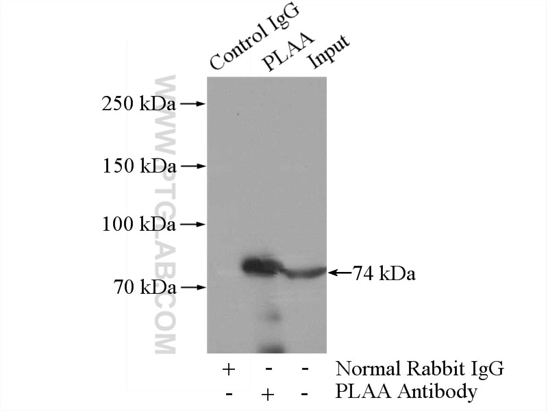 IP experiment of K-562 using 12529-1-AP