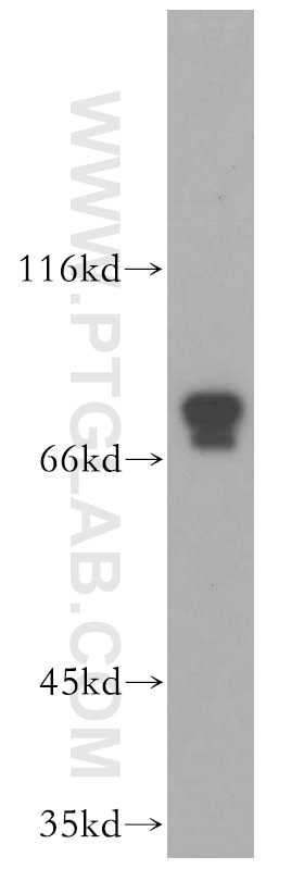 Western Blot (WB) analysis of K-562 cells using PLAA Polyclonal antibody (12529-1-AP)