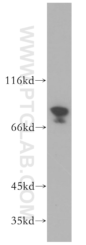 Western Blot (WB) analysis of MCF-7 cells using PLAA Polyclonal antibody (12529-1-AP)