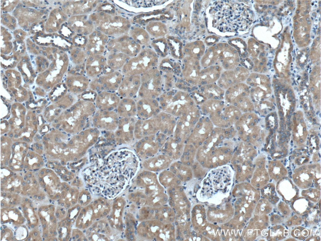 Immunohistochemistry (IHC) staining of human kidney tissue using PLAA Monoclonal antibody (60244-1-Ig)