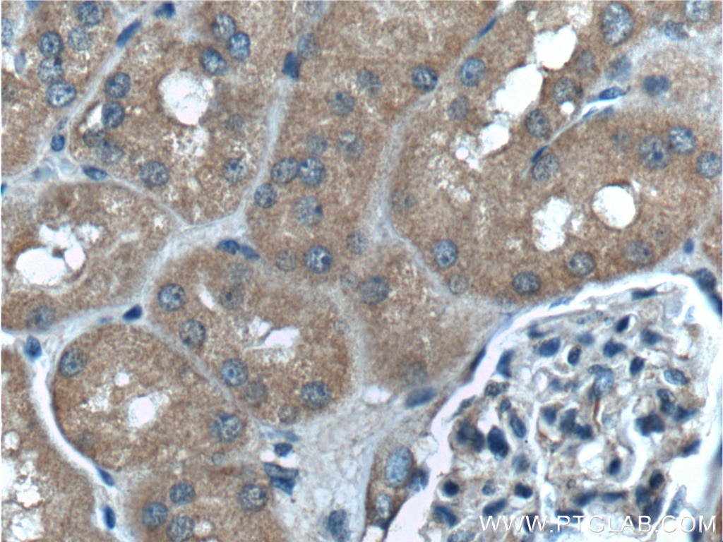 Immunohistochemistry (IHC) staining of human kidney tissue using PLAA Monoclonal antibody (60244-1-Ig)