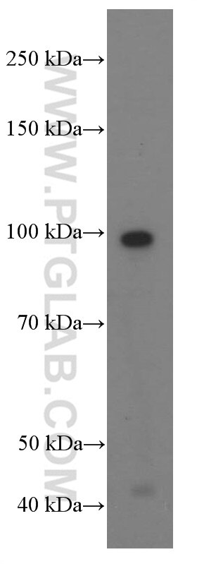 Western Blot (WB) analysis of ROS1728 cells using PLAA Monoclonal antibody (60244-1-Ig)