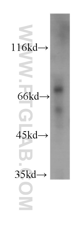 Western Blot (WB) analysis of A431 cells using PLAA Monoclonal antibody (60244-1-Ig)